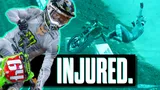 Motocross Video for RotoMoto: Austin Forkner Fractures Back in Arlington Crash