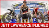 Motocross Video for VitalMX: Jett Lawrence Out of Pro Motocross with Injury
